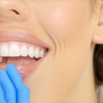 Best Invisalign & Cosmetic Dentistry Tips to Accelerate Your Smile