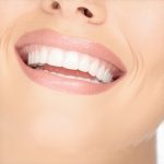 Invisalign & Cosmetic Dentistry: Proven Fast-Track Results Tips