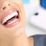 Transform Your Look with Invisalign & Cosmetic Dentistry Insights
