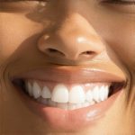 Accelerate Your Smile with Top Invisalign & Cosmetic Dentistry Tips