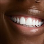 Best Cosmetic Dentistry Tips for Faster Smile Transformation