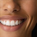 Boost Your Smile Faster with Top Invisalign & Cosmetic Dentistry Tips