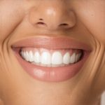 Effective Teeth Cleaning & Invisalign Strategies for Faster Results