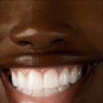 Fast-Track Your Smile with Expert Invisalign & Cosmetic Dentistry Tips