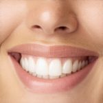 Invisalign & Cosmetic Dentistry: Speed Up Your Smile Transformation Today