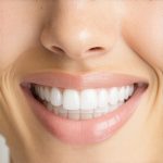 Invisalign Secrets: Accelerate Your Orthodontic Results Quickly