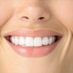Invisalign Secrets: Fast-Track Your Orthodontic Transformation