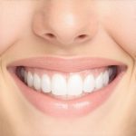 Top Cosmetic Dentistry Tips to Accelerate Your Perfect Smile