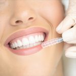 Trustworthy Teeth Cleaning & Invisalign: Accelerate Your Results Today