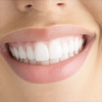 Ultimate Guide to Invisalign & Cosmetic Dentistry for Rapid Smile Transformation