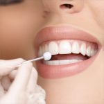 Best Invisalign & Cosmetic Dentistry Tips to Accelerate Results