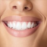 Cosmetic Dentistry: Proven Tips for Faster Smile Transformation