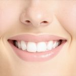Invisalign Accelerates Your Perfect Smile: Proven Strategies for Results