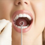 Teeth Cleaning: Proven Tips to Speed Up Your Results and Boost Confidence