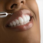 Teeth Cleaning: Proven Tips to Speed Up Your Results in 2025