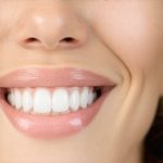 Top Cosmetic Dentistry Tips to Accelerate Your Perfect Smile in 2025