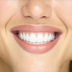 Trusted Teeth Cleaning & Dentist Tips to Accelerate Your Dental Results Today