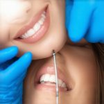 Trustworthy Teeth Cleaning & Cosmetic Dentistry Tips for Faster Results