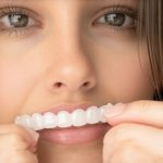 3 Quick 2026 Fixes When Your Invisalign Trays Aren't Fitting