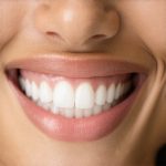 Cosmetic Dentistry & Invisalign: Accelerate Your Perfect Smile Now