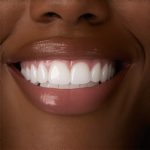 Invisalign & Cosmetic Dentistry: Accelerate Your Perfect Smile Today