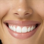 Invisalign & Cosmetic Dentistry: Accelerate Your Smile Transformation Today