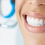 Invisalign & Cosmetic Dentistry: Effective Tips for Faster Results