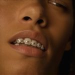 Invisalign Results: 5 Daily Habits Slowing You Down in 2026