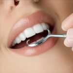Teeth Cleaning: Accelerate Results with Expert Dental Tips