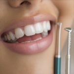 3 Proven Fixes for Loose Invisalign Attachments in 2026