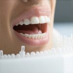 4 Ways to Fix Invisalign Gaps and Improve Tray Tracking in 2026