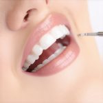 5 Hidden Reasons Your 2026 Teeth Cleaning Feels Painful