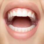 5 Signs Your Dentist Missed Bacteria During Your 2026 Cleaning