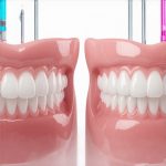 Is 2026 Bioceramic Bonding Better Than Veneers? [Price Check]