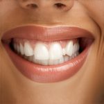 Is Airflow Teeth Cleaning Worth the Cost? 2026 Pros & Cons