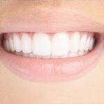 Is Your 2026 Invisalign Tracking Off? Look for These 4 Signs