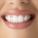 Stop Guessing: Why Your 2026 Invisalign Plan Needs AI Tracking