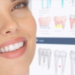 Stop Tracking Errors: 4 Invisalign Fixes for Faster 2026 Results