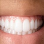 Why 2026 Teeth Cleaning Now Includes Micro-Shield Protection