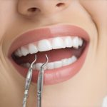 Why You Need the New 2026 Biofilm Tool at Your Teeth Cleaning