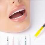 Why Your 2026 Teeth Cleaning Now Includes DNA Saliva Testing