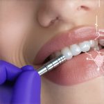 Why Your 2026 Teeth Cleaning Now Includes a Digital Gum Map