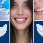 3 Smart-Bracket Fixes for Faster Invisalign Shifts in 2026