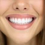 4 New 2026 Tactics to Stop Receding Gums After Invisalign