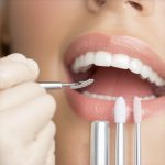 4 Reasons to Ask for Calcium-Phosphate Polish in 2026