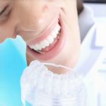 4 Simple Fixes for Invisalign Tray Lag in 2026