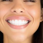 5 2026 Invisalign Fit Hacks to Stop Tray Lag [Tested]