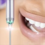 Is Your 2026 Teeth Cleaning Outdated? The New Liquid-Ion Standard
