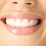 Why 2026 Teeth Cleanings Now Need a Nano-Hydroxyapatite Shield