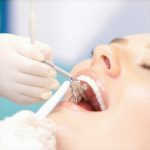 Why 2026 Teeth Cleanings Now Use Galvanic Sweeps to Clear Plaque